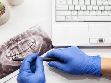 Especialista revisando una radiografía