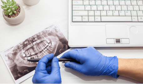 cirugia-maxilofacial-prodentix 1